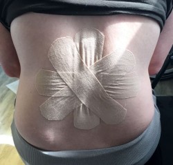 Kinesio Taping am Rücken